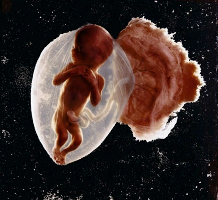 life-begins