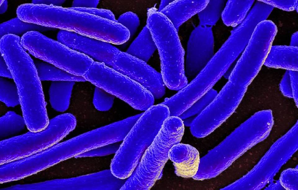 E Coli